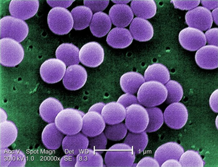 オーストラリアで医療に従事するために必要な手続き（５） MRSA Screening